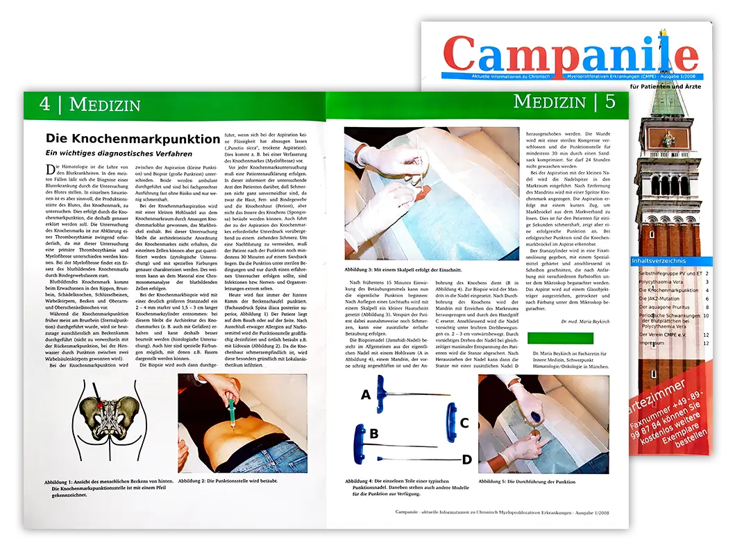 Die Zeitschrift Campanile: Titelseite und aufgeschlagene Doppelseite