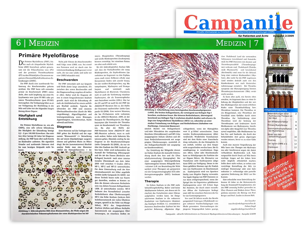 Die Zeitschrift Campanile: Ausgabe mit Artikel zur primären Myelofibrose